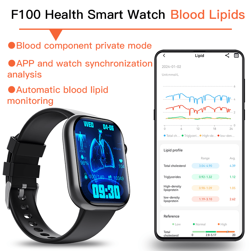 Best ECG Smart Watch of 2025 With Blood Pressure Monitor+Blood Glucose Monitoring - Partij stunter