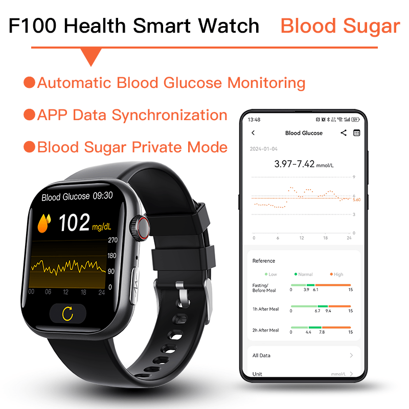 Best ECG Smart Watch of 2025 With Blood Pressure Monitor+Blood Glucose Monitoring - Partij stunter